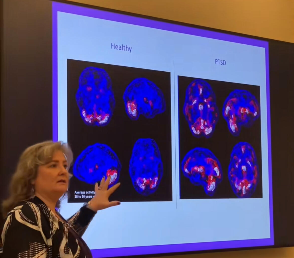 “Đối với người phì quý (肥贵人), đó là bệnh ‘cao lương’, tức là do tích trệ khí huyết gây ra.”